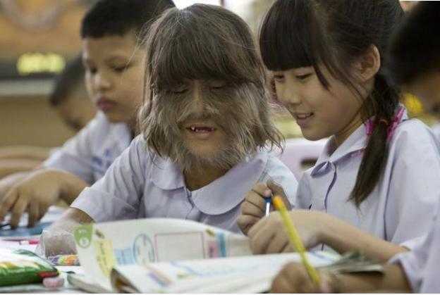 Dünyanın ən tüklü qızını bir də indi görün -  FOTOLAR